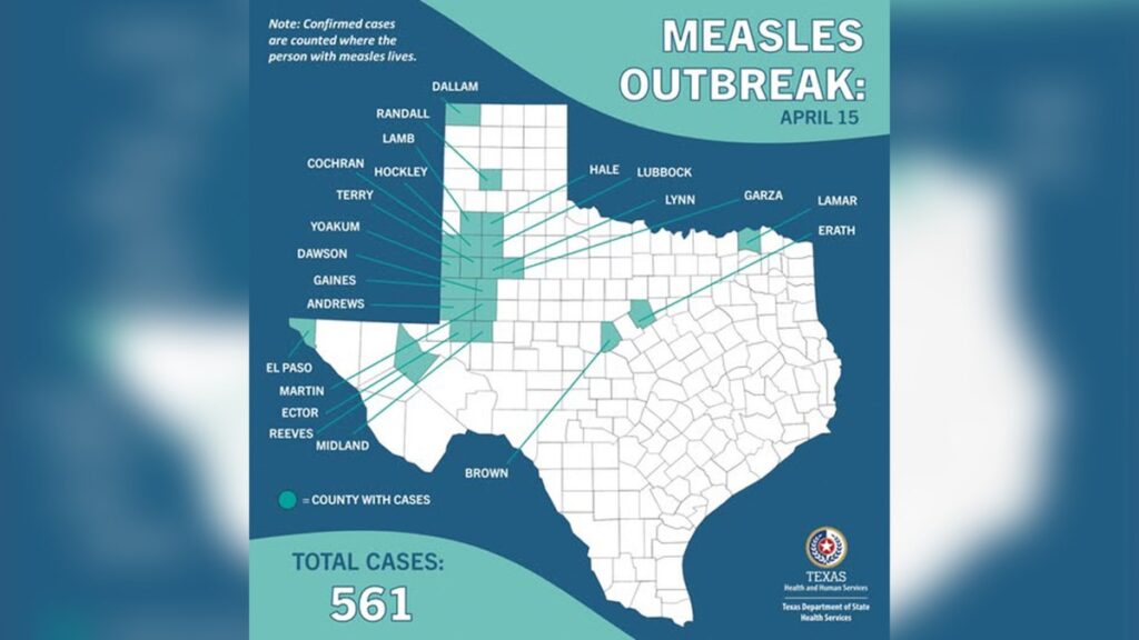 1744831263 measles.jpg