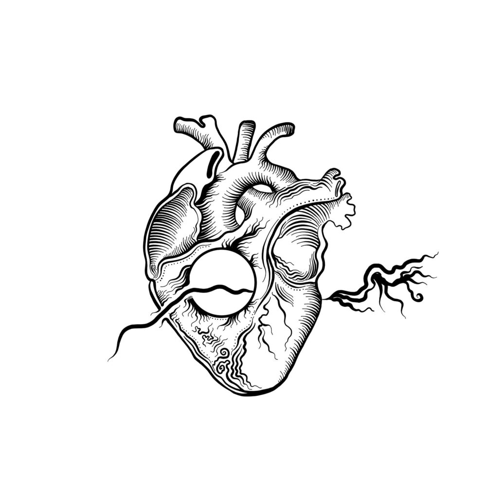 Heart transplant.jpg