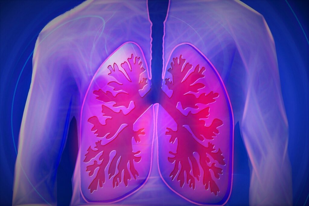 Lung 1.jpg