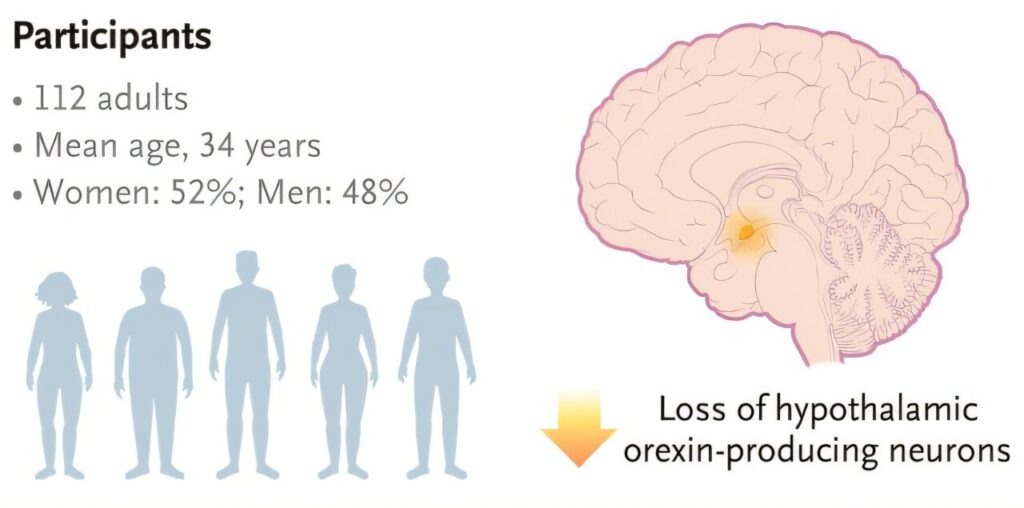 Oveporexton shows prom.jpg