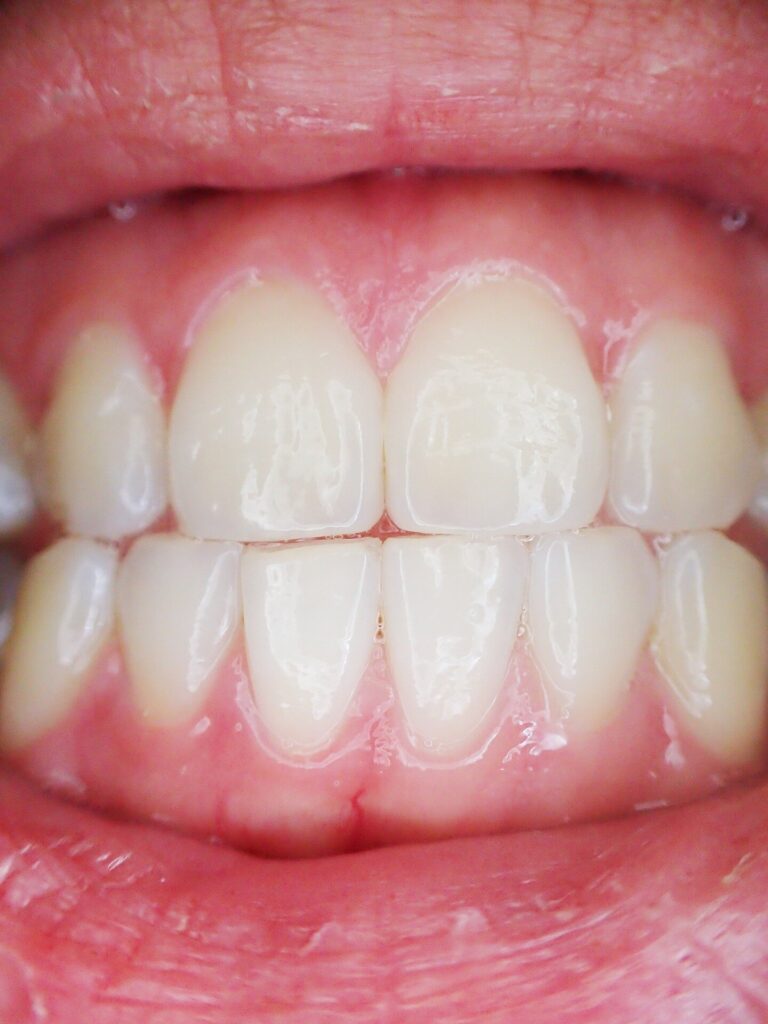 Teeth and gums.jpg