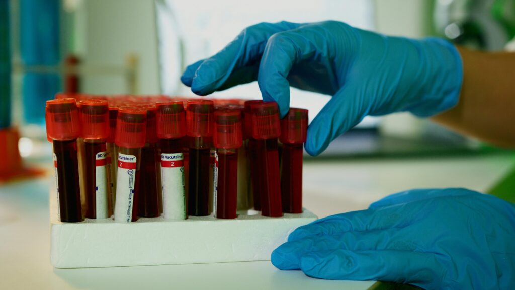 Blood test 1.jpg