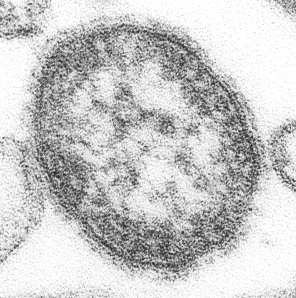 Measles.jpg
