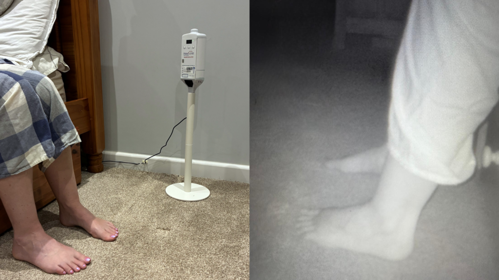 Skynews ai foot scanner 6933805.png