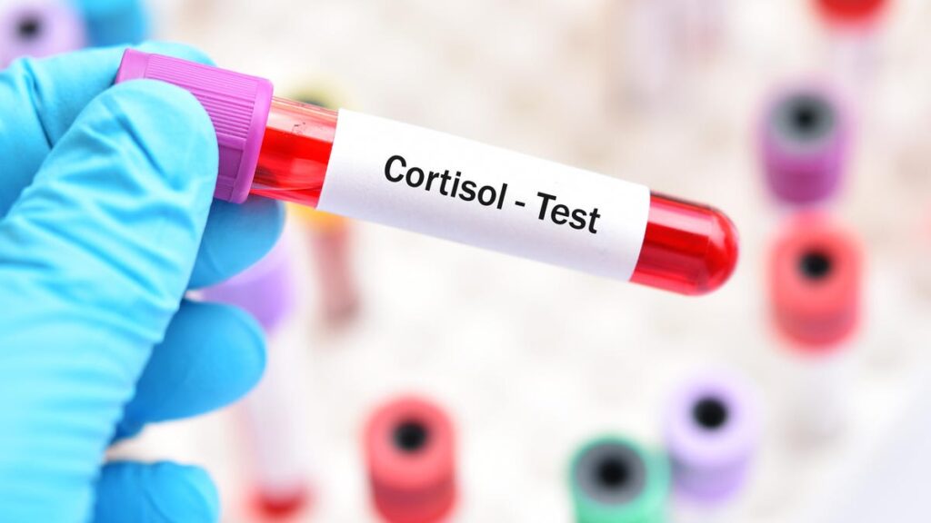 Cortisol blood test.jpg