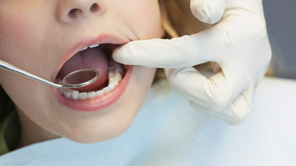 Skynews dentist dentistry 6811120.jpg